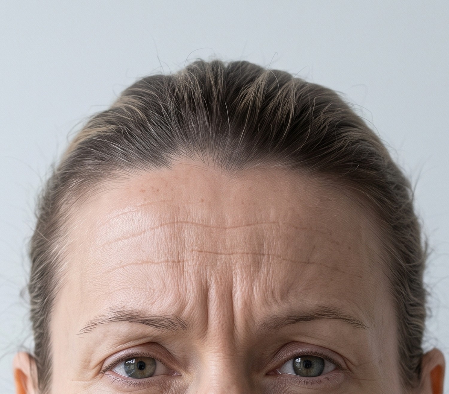 A woman photographed straight on in the north window, hair tied back, no makeup, before treatment.
